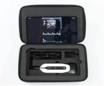 全數(shù)字掌上彩色多普勒超聲診斷儀sonoeye v1ws廠家